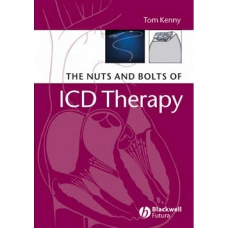 The Nuts and Bolts of ICD Therapy (Nuts and Bolts Series (Replaced by 5113)) - Walmart.ca