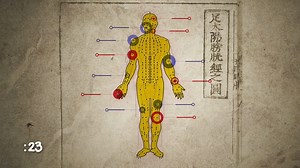 Can you use pain to stop pain? Here's a look at the history and benefits of acupuncture. | WebMD