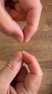 3.1K views · 93 reactions | finger tapping test: 正式な方法ではありませんが、明らかに左手が異常です。思い返せばこれが初発症状だったかも。安静時振戦がないのに、随意運動を邪魔するように背景に潜在する振戦が表に出てきたようにも見えます。不思議不思議類 | Kazuhisa Domen | Facebook