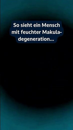 Bei der feuchten Makuladegeneration (AMD) wird das zentrale Sehen geschädigt
