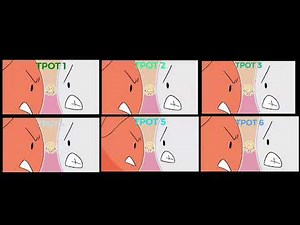 Tpot 1-6 intro comparison