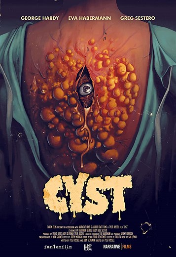 Cyst (2020) | ČSFD.cz