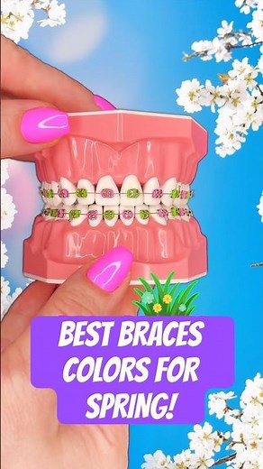BEST BRACES COLORS FOR SPRING?! Which one is your favorite ?! #braces #bracescolors #spring