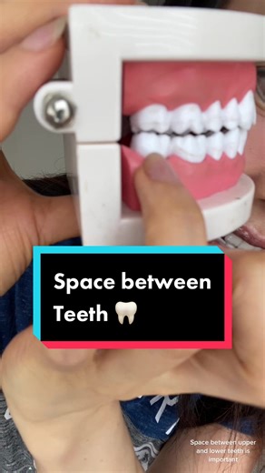 Importance of Space Between Upper and Lower Teeth