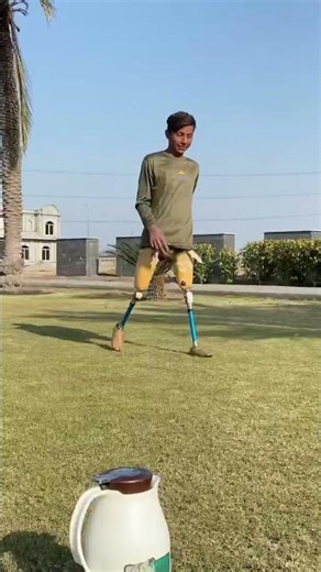 Prosthesis leg fitting artificial | Best walking above knee prosthesis leg / #hassanzarar#shortsfeed