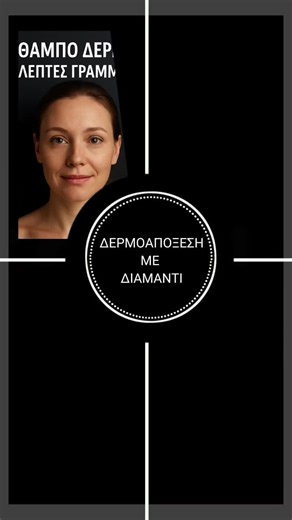 ✨ Λάμψη & Αναζωογόνηση με Δερμοαπόξεση Διαμαντιού ✨ Η δερμοαπόξεση με διαμάντι απομακρύνει τα νεκρά κύτταρα, βελτιώνει την υφή και χαρίζει πιο φωτεινό, λείο & νεανικό δέρμα. 💎 ✔️ Θαμπή επιδερμίδα ✔️ Λεπτές γραμμές ✔️ Ουλές & σημάδια ακμής Χαρίστε στο δέρμα σας την περιποίηση που του αξίζει! 🌸 #Δερμοαπόξεση #DiamondPeeling #GlowingSkin #skincareroutin #forup