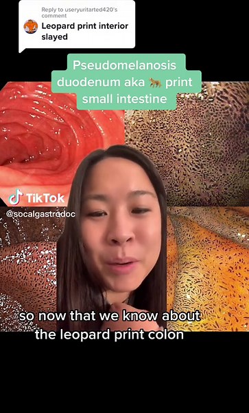 Endoscopic Views of Small Intestine | Gastroenterology Insights