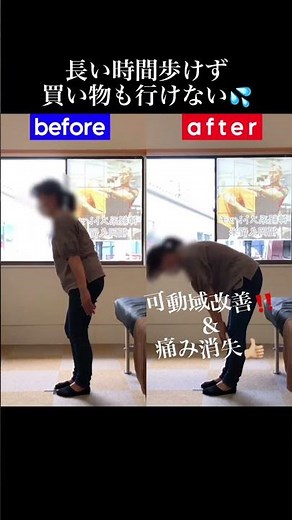 脊柱管狭窄症を改善解消【兼子ただし】神経系ストレッチ福岡久留米【激痛整体施術】#脊柱管狭窄症 #兼子ただし #兼子ただしストレッチ