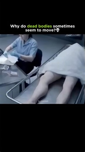 Medical | Science | Facts on Instagram: "The leg movements of the corpse seen in the video are not actually a sign of rebirth, but rather a natural reaction of the body after death. When a person dies, the brain has indeed stopped functioning, but the muscles still retain a small amount of electrical energy. This residual energy can cause the muscles to suddenly twitch, flex, or move slightly even though the person is no longer alive. This phenomenon is called the postmortem reflex, and it often