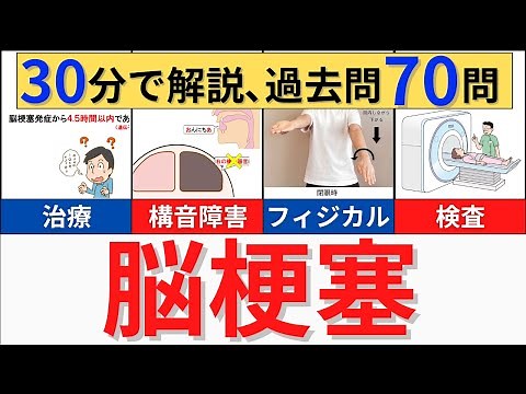 【30分解説】脳梗塞の病態・症状・フィジカル・検査・治療について解説