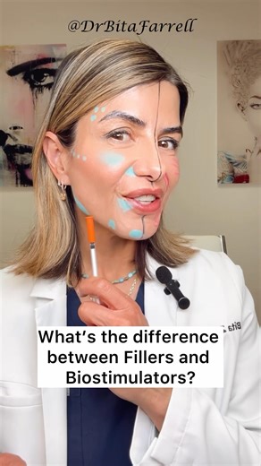 #filler #biostimulator #sculptra #naturalaestheticscenter #drbitafarrell