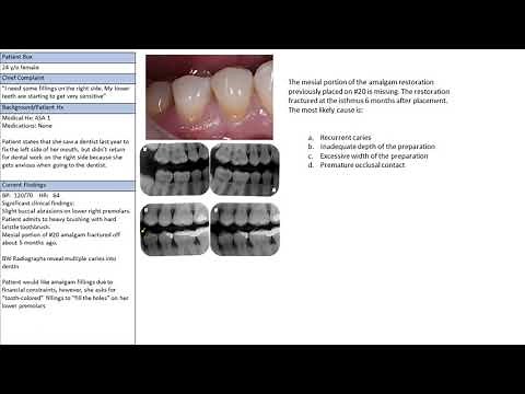 INBDE Remembered Question sample operative