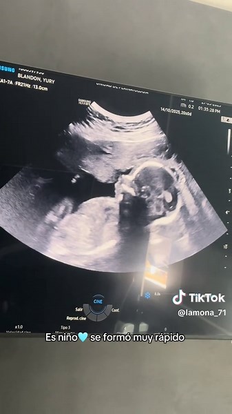 Mi niña soñada mi princesa Ariana gracias Dios #mamaprimeriza #girlmom 🥰🥹🙏