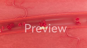 tyflow sim blood Vascular blockage