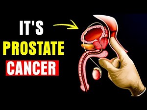These 10 Signs Are Indications of Prostate Cancer You should not ignore.