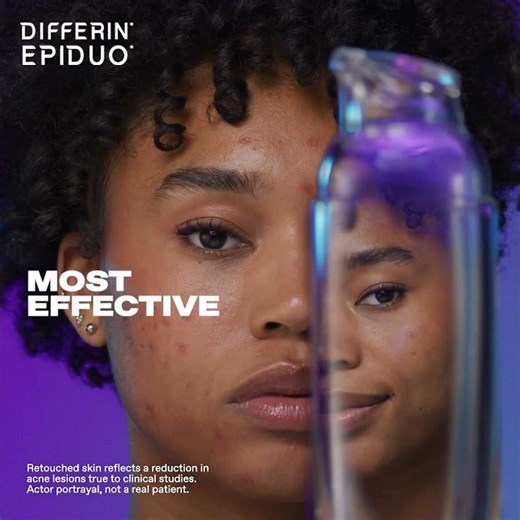 Differin Epiduo Acne Gel is the first clinically proven formula to help clear and prevent acne.