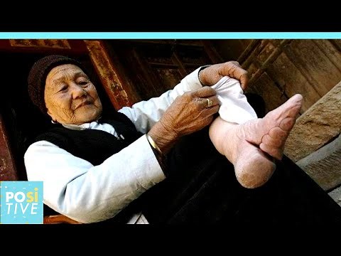 "Lotus Feet": the ancient Chinese tradition that made women suffer