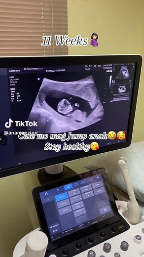 11 Weeks Ultrasound Baby Moving in Stomach | Cute Pregnancy Video