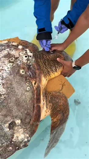 turtlehospital on Instagram: "More “Harlow” The Loggerhead Sea Turtle Treatment ❤️‍🩹🐢 In this video, we are giving Harlow dextrose plus IV fluids and subcutaneously, broad-spectrum antibiotics, and vitamins. She is also being fed more of her natural honey-filled squid. 🦑🍯 She has been getting supportive fluid treatment like this every 4 hours. As her blood levels stabilize, she will be getting these fluid treatments less frequently. 💉💧 She continues to stay strong through it all. Thank you