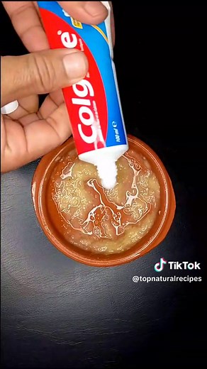 The Perfect Tooth Brushing Routine: A Guide to a Healthier Smile Achieve a sparkling smile with our ultimate tooth brushing guide! 🦷✨ Discover the secrets to proper brushing techniques, the best types of toothbrushes and toothpaste, and tips for maintaining oral hygiene. Watch now to ensure your teeth are as healthy as they are beautiful! #OralHygiene #HealthySmile #ToothBrushingTips#الشعب_الصيني_ماله_حل😂😂 #اكسبلورexplore #skincare