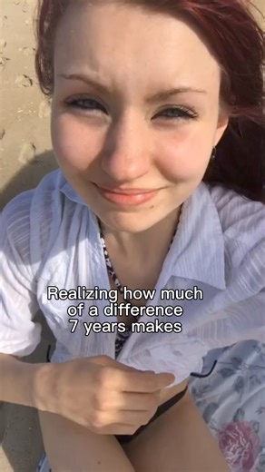 2.7K views · 23 reactions | 7 year glow up (I don’t miss the red) | Emma Sirus | Facebook