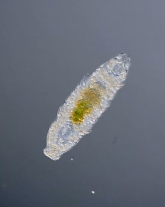 66K views · 695 reactions | Water bears are Earth's true extreme survivalists.  These eight-legged micro animals have endured all five mass extinctions and are known to be able to survive in nearly any environment. 匿 by My Microscopic World #waterbear #microscope | Science Channel | Facebook