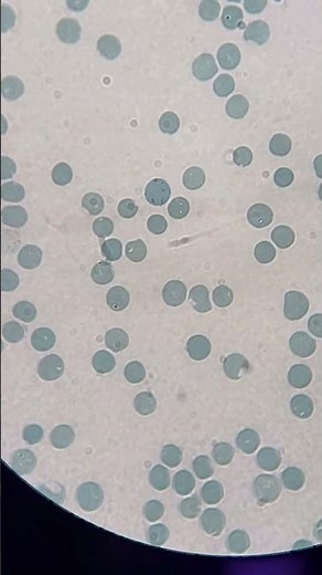 #Reticulocyte Under the #microscope | #hematology Insights