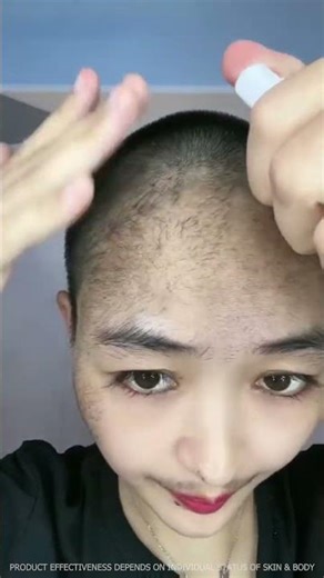 FEG Plus - Hair Growth Serum #fegplus #hairserum