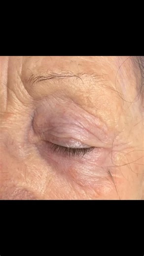 ✨ Laminado de cejas: un antes y después que habla por sí solo En cejas maduras, cada detalle cuenta. Con un laminado bien trabajado conseguimos elevar, ordenar y definir sin endurecer la mirada. El resultado: unas cejas más ligeras, naturales y con un efecto lifting inmediato que rejuvenece sin cambiar su expresión. Un tratamiento suave, pensado para realzar y respetar. En @imagen23evagonzalez , la belleza siempre va de la mano de la naturalidad. — ¿Quieres este acabado en tus cejas? Te esperamo