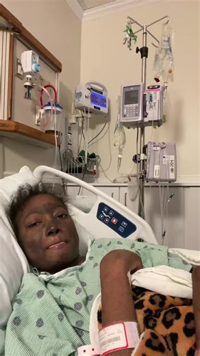 Understanding Lupus: Raising Awareness and Support