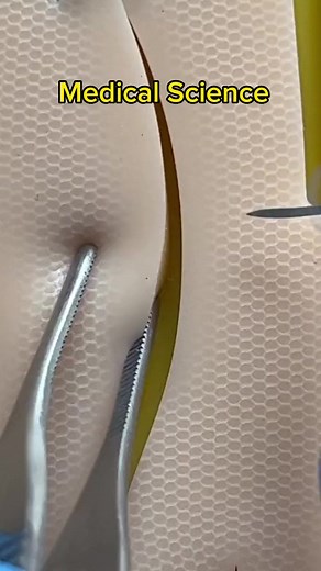 1.3M views · 6K reactions | #sutures #technique #medicalstudent #medicine #SharePost | Medical Science | Facebook