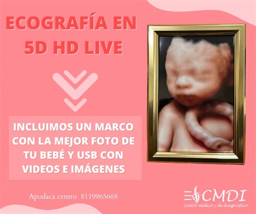 ¿Te gustaria tener este recuerdo? Ahora incluimos en tu estudio un marco de foto para la mejor imagen de tu bebé✨ ✅ Entegamos imagenes impresas en 5D ✅ Ecografia convencional en donde valoramos el peso y la edad gestacional asi como placenta, liquido amniotico y latidos cardiacos asi como el reporte por escrito. ✅ USB con videos e imagenes ✅ Marco con la mejor foto de tu bebé ✅ Chocolatito en caso de que el bebé no quiera cooperar 81 1996 5668 . . . #ecografía #ecografia #ecografías #ecografias 