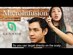 How effective is Micro Infusion Derma Stamp or Microneedling treatment for hair loss?