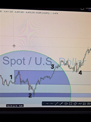 Xau/Usd Trading #trading #forex