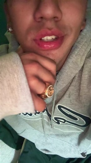 Bésame bésame 😵‍💫😵‍💫