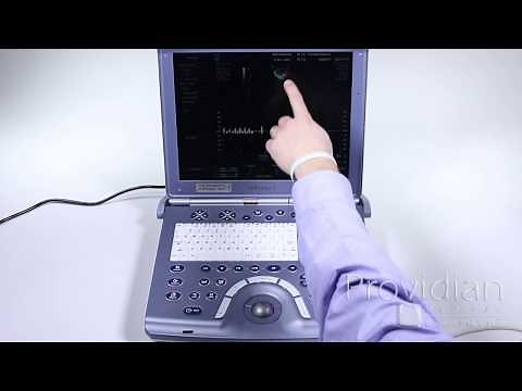 GE Voluson i Training Part 3: Doppler and M-Mode