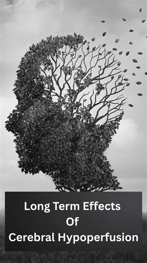 What are the long-term effects of cerebral hypoperfusion? When the brain doesn’t get enough blood flow, it’s like running a high-performance engine without enough fuel. Over time, that lack of circulation can quietly wear things down — leading to memory issues, slower thinking, emotional changes, or even vascular dementia in some cases. But here’s the thing most people don’t realize — your brain isn’t “broken.” It’s just tired. It’s been running on low power for too long. Cerebral hypoperfusion 