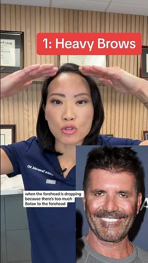 3 Signs You've Overdone Botox