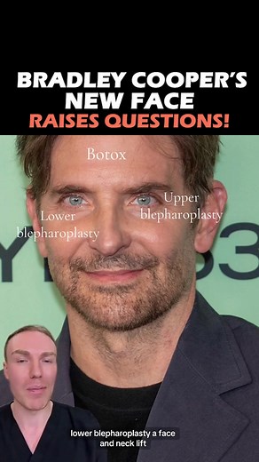 Bradley Cooper's New Face Raises Questions! Bradley Cooper just showed up looking completely different — and fans can’t stop talking about his face! 👀 Did he really go under the knife… or is this just love changing him?💔💉 | REIDframed Studios