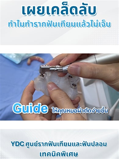 All-on-4 แบบ Computer Guide ดีกว่ายังไง? การทำ All-on-4 ไม่ได้วัดกันแค่ “ใส่ได้” แต่ต้องวัดกันที่ ความแม่นยำ ความปลอดภัย และการใช้งานระยะยาว ที่ YDC เราเลือกใช้ Computer Guided All-on-4 เพื่อให้ทุกขั้นตอนถูกวางแผนล่วงหน้าบนคอมพิวเตอร์ - วางตำแหน่งรากฟันเทียมจาก CT Scan - แผลผ่าตัดเล็ก เจ็บน้อย ฟื้นตัวไว - วางแผนฟันให้สวยและใช้งานได้จริงตั้งแต่ต้น - ลดความเสี่ยง ได้ผลลัพท์การรักษาที่ความแม่นยำ . YDC ศูนย์บริการรากฟันเทียมและฟันปลอม ให้การรักษาโดยแพทย์เฉพาะทาง ด้านรากฟันเทียมและฟันปลอม เทคนิคพิเศษ