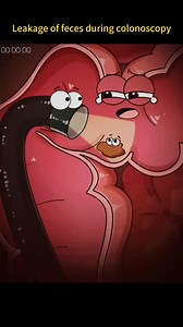 1.1M views · 2.2K reactions | #colonoscopy #feces #leakage #foryou #fypシ #sciencefacts #mathematics#physics#life #subject #science #quantumphysics, #fyp #foryou #tiktok #lnteresting#science#physics | Sience | Facebook