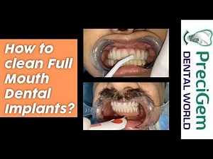 How to clean Full Mouth Dental Implants? | best dental implant surgeon explains || Dr Mayur Khairnar