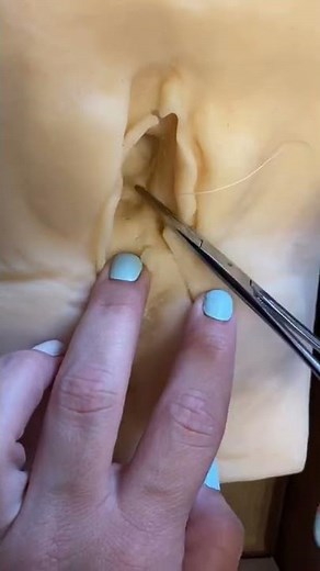 Episiotomy repair.. my student practicing