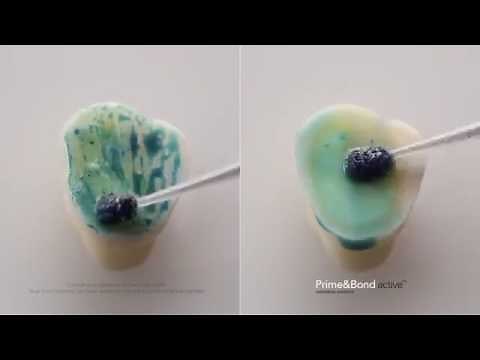 Dentsply Sirona: Prime & Bond Active - Animation