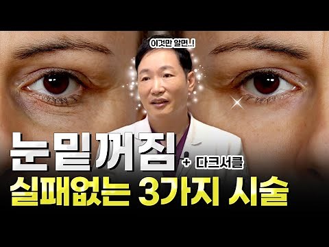 눈밑꺼짐 다크서클 추천시술 3가지! 이렇게만 하면 성공합니다!