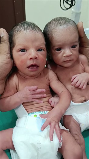 cute twins baby 🥰