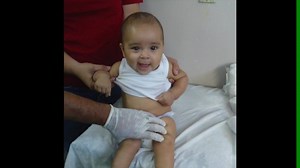 Kids from around the world are inspired by the Olympics and they all deserve a chance to dream. Learn how you can help a child with clubfoot today: http://bit.ly/2aXLOTQ | MiracleFeet