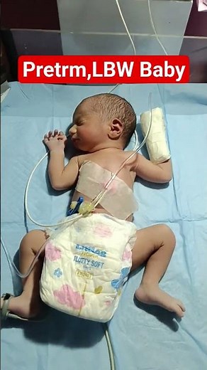 Pretrm , LBW Baby🧬 #nicu #baby #cutebaby #cute