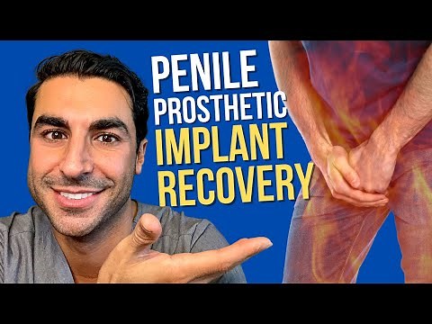 What is the Recovery after Penile Prosthesis Implant Surgery | Los Angeles Surgeon Justin Houman MD