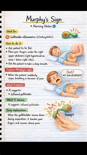 Murphy's Sign and McBurney's sign, important Body's Signs, important for exams and viva's #murphy